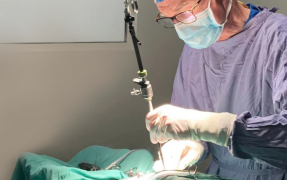 keyhole surgery also known as laparoscopy